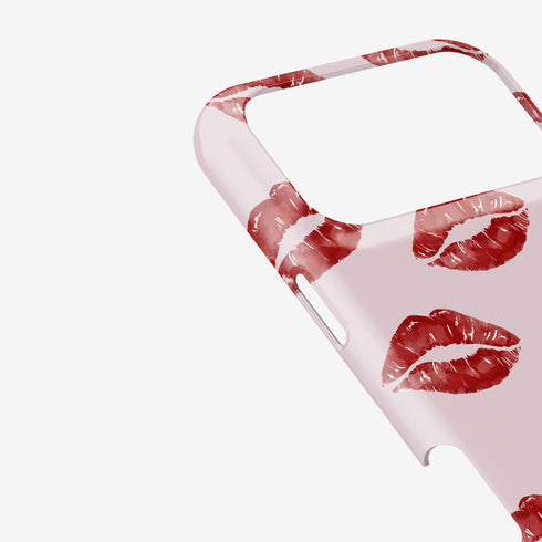 Kiss